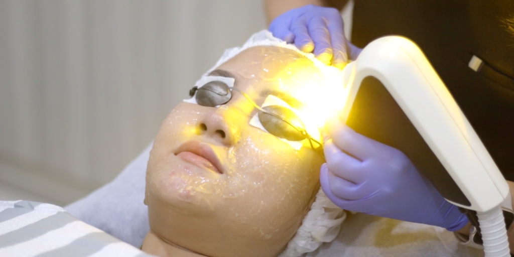Apa Saja Layanan Laser Wajah yang Ada di Miracle Clinic?